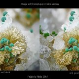 Mimetite with Malachite
fov 5.2 mm.
(Autor: ploum)