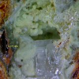 Cerusita y Piromorfita.
4´177x 3´133 mm.
(Autor: Jesus Franquesa Baucells)